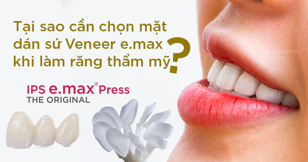 Tại sao cần chọn mặt dán sứ veneer e.max khi làm răng thẩm mỹ?