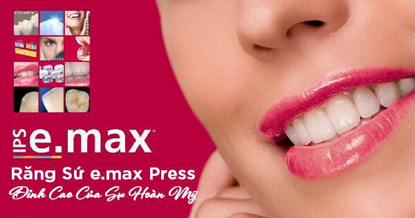 Răng Sứ e.max Press - Đỉnh Cao Của Sự Hoàn Mỹ